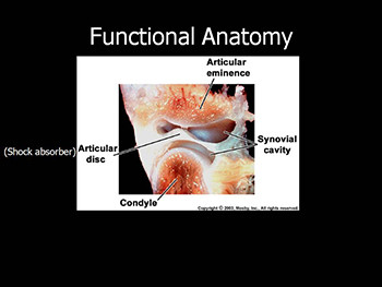 Headaches Attributed To Temporomandibular Disorders