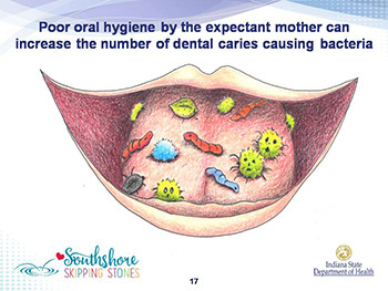 Oral Health For Mothers Infants And Children