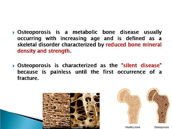 Rehabilitation In Osteoporosis