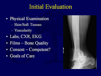 Epidemiology Diagnosis Prevention and Management of Osteoporotic Fractures