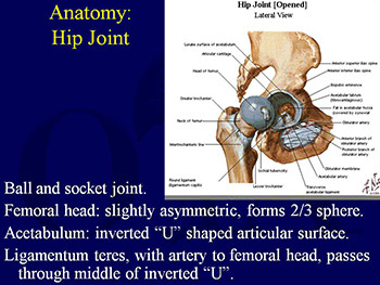 Hip Dislocations and Femoral Head Fractures