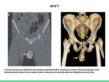 Orthopedic Emergencies