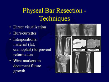 Basic Principles in The Assessment and Treatment of Fractures in Skeletally Immature Patients