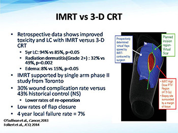 Radiation Therapy As A Component of Multidisciplinary Sarcoma Management