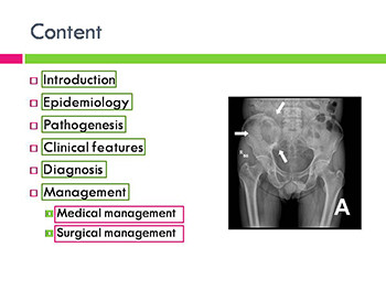 Secondaries in Bone