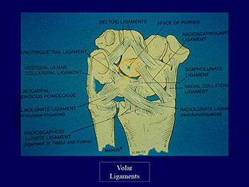 Carpal Fractures and Dislocations