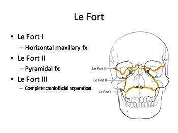 Maxillofacial Trauma Reconstruction of Facial Defects