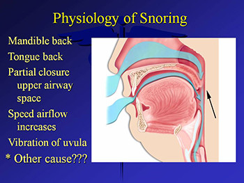 Sleep Disordered Breathing and Dentistry