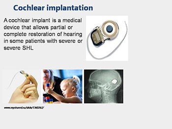 Non-Purulent Ear Diseases