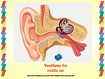 Presentations of Middle Ear Disease
