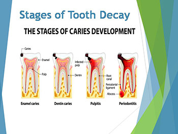 Basics of Oral Health Presentation
