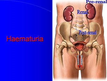 Emergency in Urology