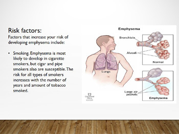 Obstructive Pulmonary Diseases