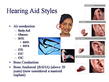 Hearing Aids