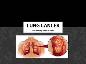 Lung Cancer