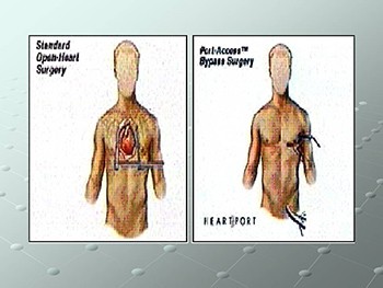 Robotic Surgery