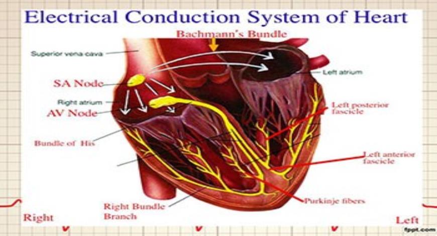 Download Free Medical EKG Interpretation PowerPoint Presentation