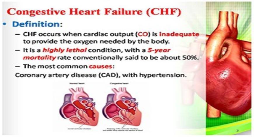 powerpoint presentation on congestive heart failure