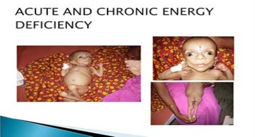 Download Free Medical Deficiency Disorders PowerPoint Presentation