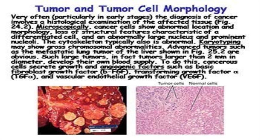 Download Free Medical Cancer PowerPoint Presentation