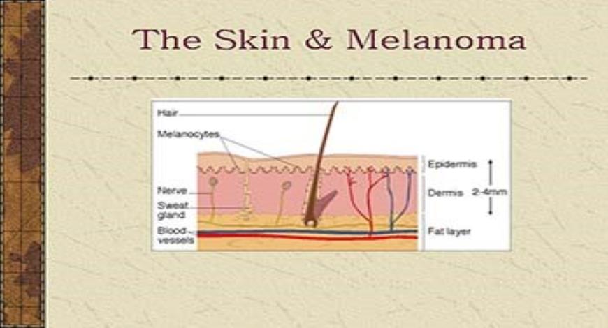 Download Free Medical Skin Cancer: What You Should Know PowerPoint ...