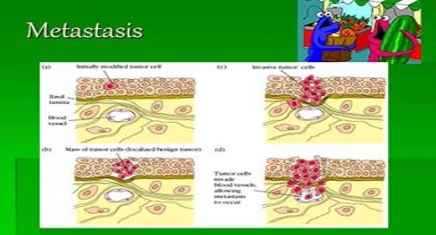 Download Free Medical Cancer and the Immune System PowerPoint Presentation