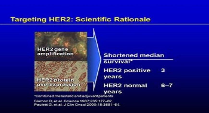 Download Free Medical Management of HER2 Positive Metastatic Breast ...
