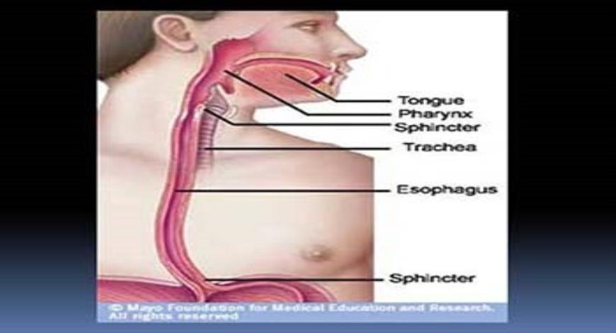 download free medical dysphagia causes and management powerpoint presentation