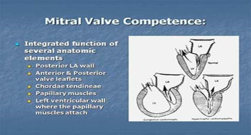 Download Free Medical Valvular Heart Disease PowerPoint Presentation