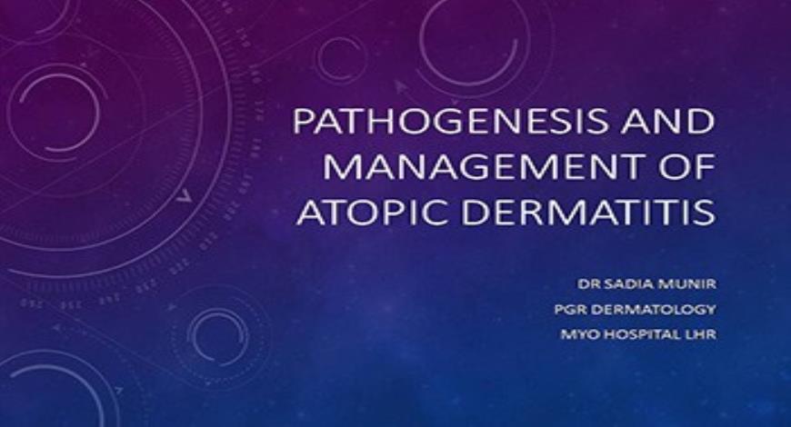 PATHOGENESIS AND MANAGEMENT OF ATOPIC DERMATITIS Medical Presentation