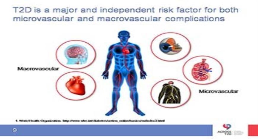 Download Free Medical Cardiovascular disease and Type 2 Diabetes ...