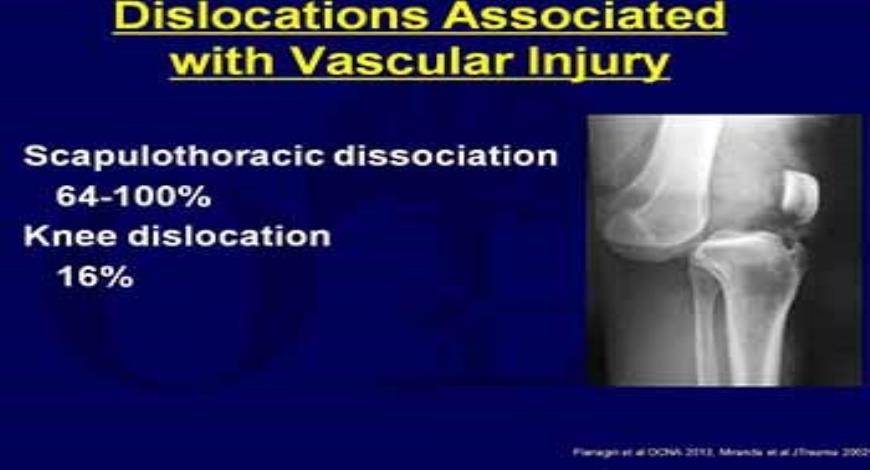 Download Free Medical Evaluation and Treatment of Vascular Injury ...