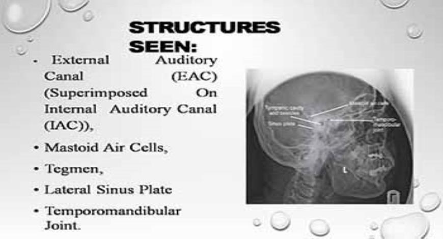 Download Free Medical Radiology Head And Neck Powerpoint Presentation