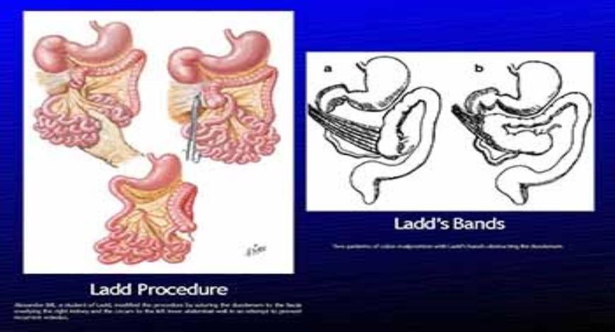 Download Free Medical The Radiology of Malrotation PowerPoint Presentation