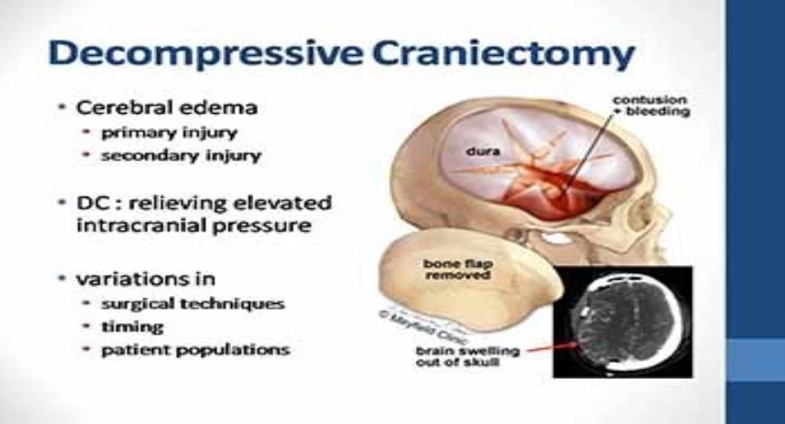 Download Free Medical Guidelines for the Management of Severe Traumatic ...