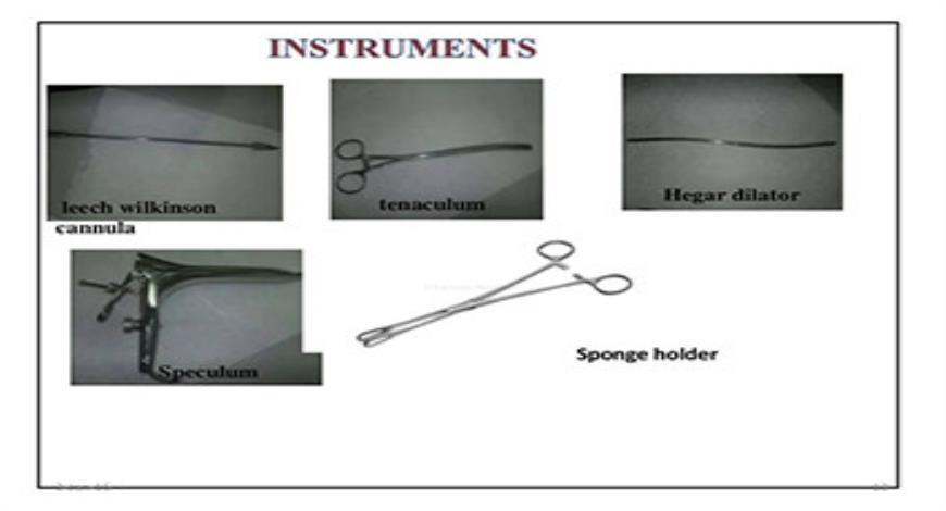 Download Free Medical Hysterosalphingography PowerPoint Presentation