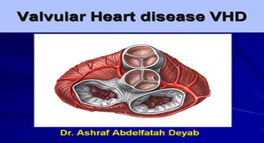 Download Free Medical Valvular Heart Disease PowerPoint Presentation