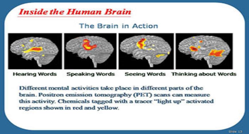 Download Free Medical Alzheimers Disease-Unraveling the Mystery ...