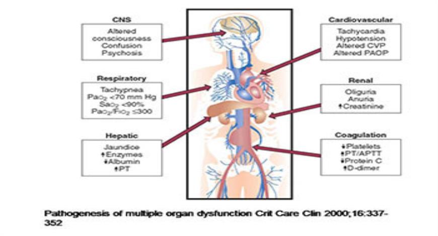 Download Free Medical Multiple Organ Dysfunction Syndrome PowerPoint ...