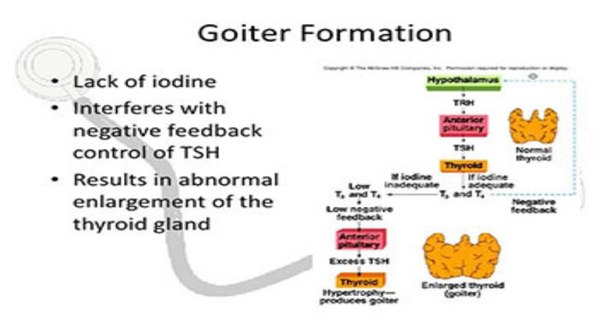 Download Free Medical Thyroid Gland Disorders PowerPoint Presentation