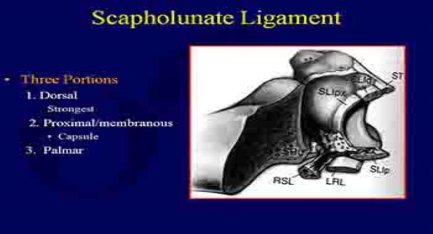 Download Free Medical Carpal Fractures and Dislocations PowerPoint ...