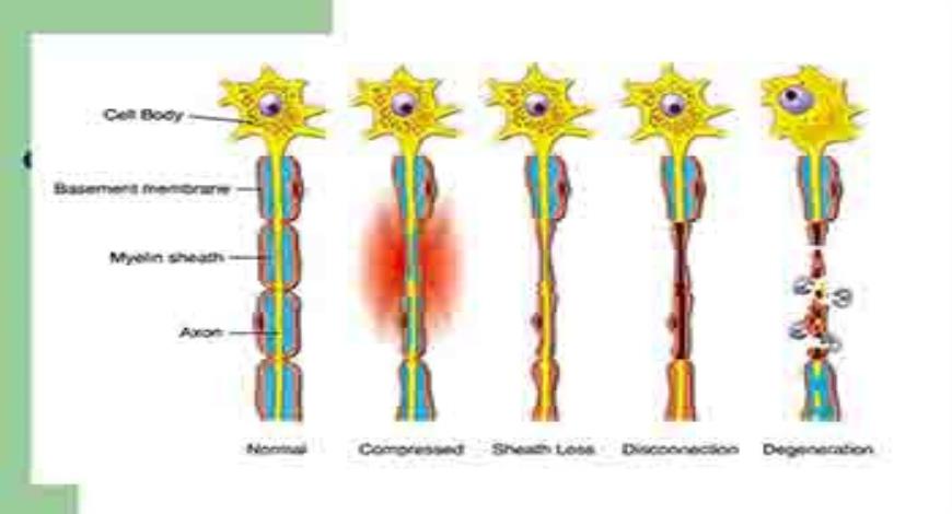 Download Free Medical Peripheral Nerve Injuries PowerPoint Presentation