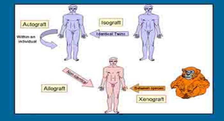 Download Free Medical Priniciples of Transplantation PowerPoint ...