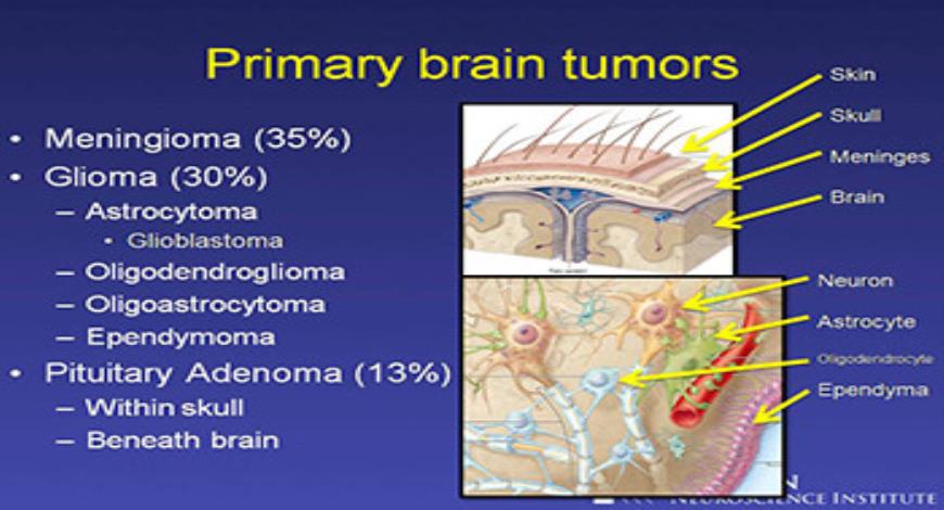 Download Free Medical About Brain Tumors PowerPoint Presentation