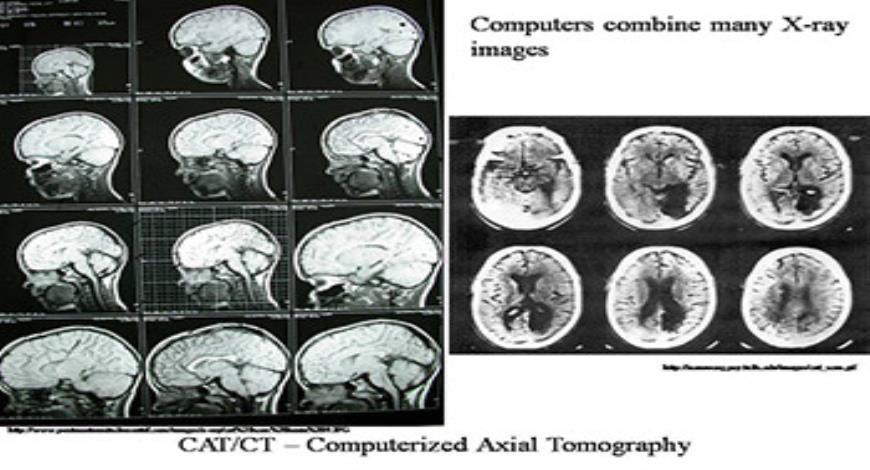 Download Free Medical Brain Scans PowerPoint Presentation