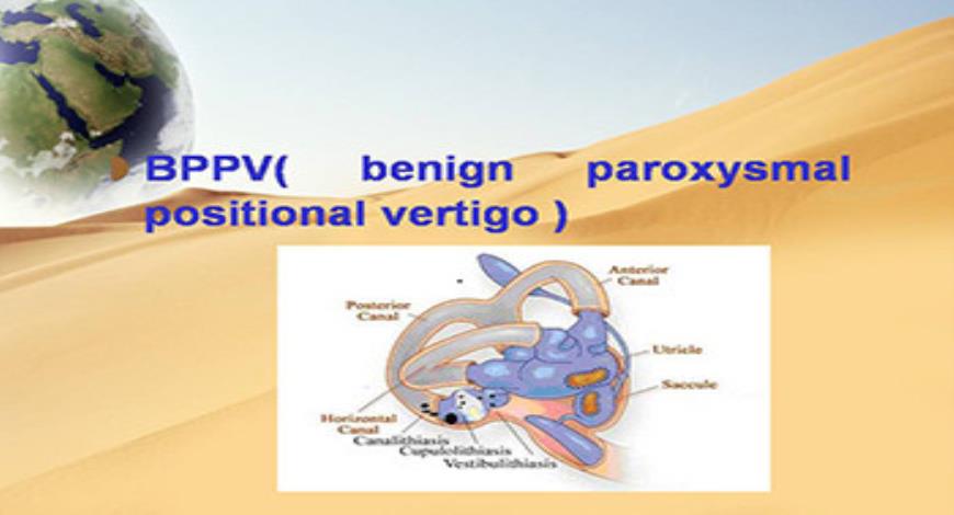 Download Free Medical About Vertigo PowerPoint Presentation