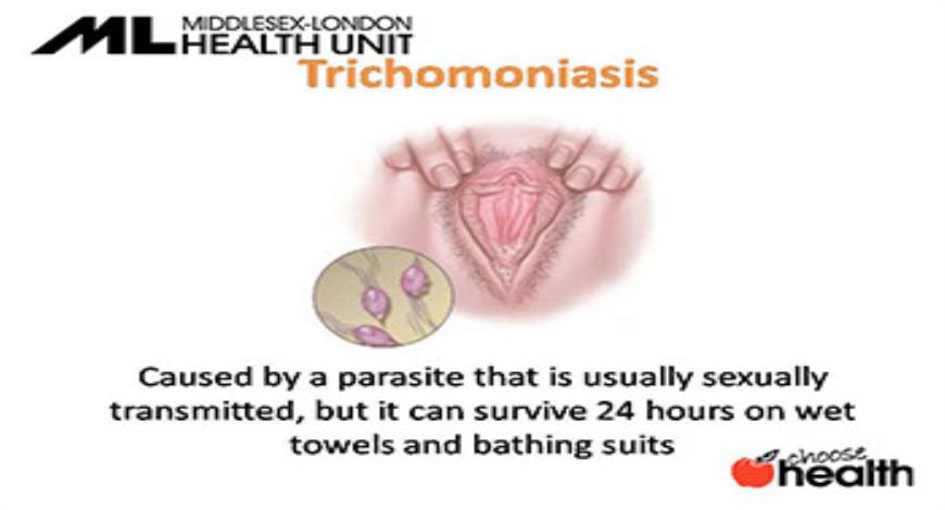Download Free Medical Sexually Transmitted Infection-STI PowerPoint ...