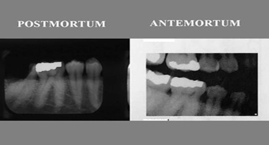 Download Free Medical Forensic Odontology PowerPoint Presentation