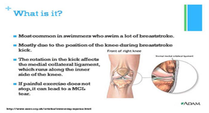 Download Free Medical Swimming Injuries PowerPoint Presentation