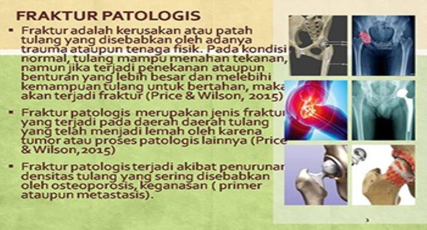 Download Free Medical Hip Replacement PowerPoint Presentation
